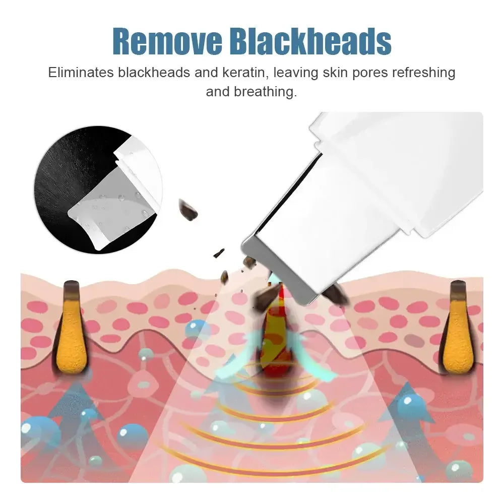 Deep Vibrate Skin Scrubber (Milky White, Black)