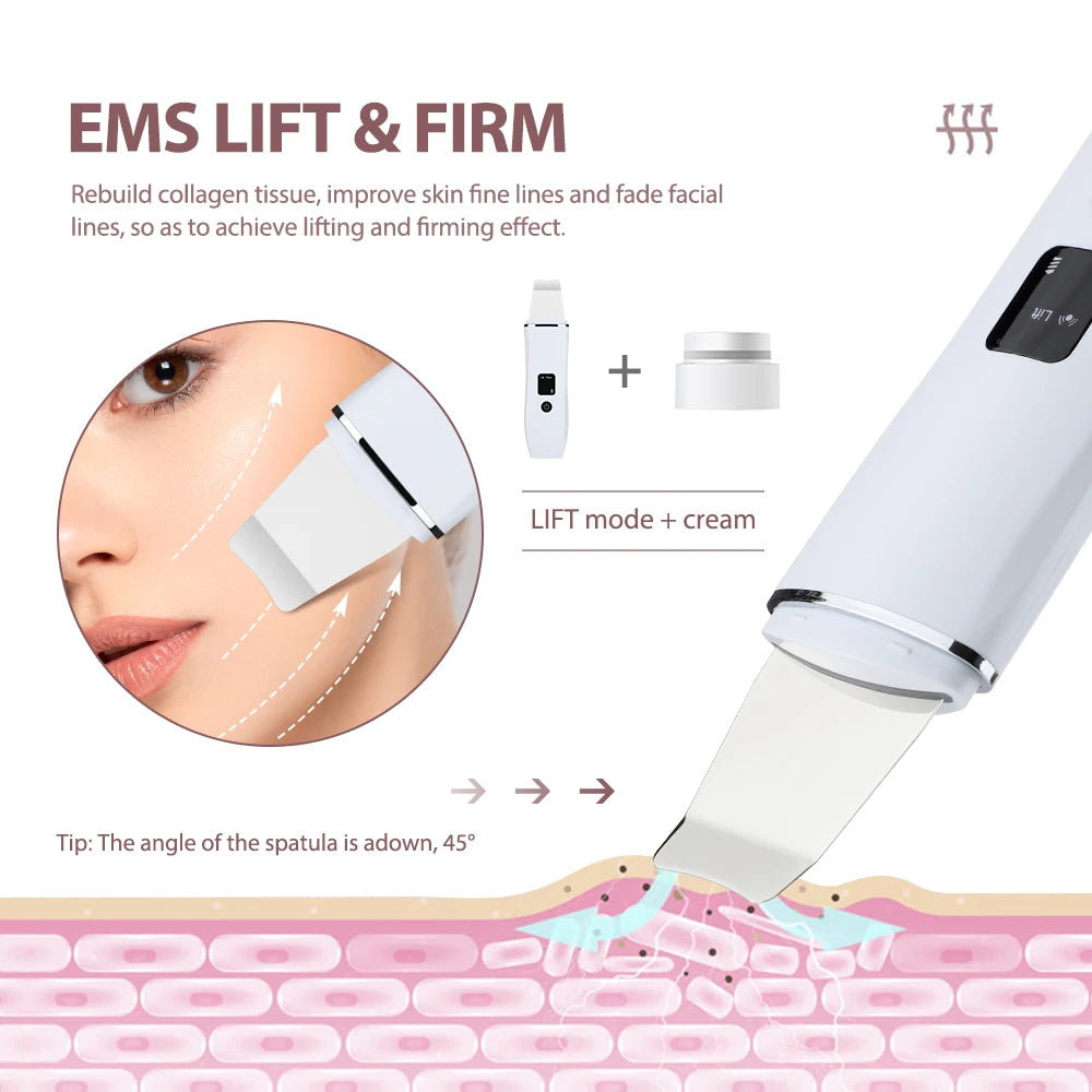 Ultrasonic Skin Scrubber (White)
